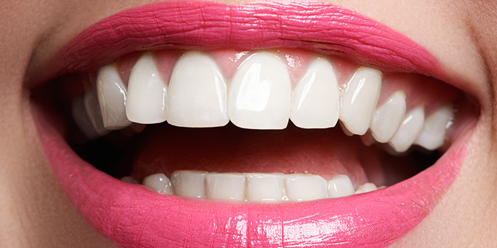 ホワイトニングで白く美しい歯を手に入れましょう