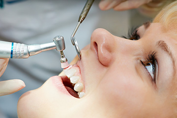 歯周病は予防することが大切です